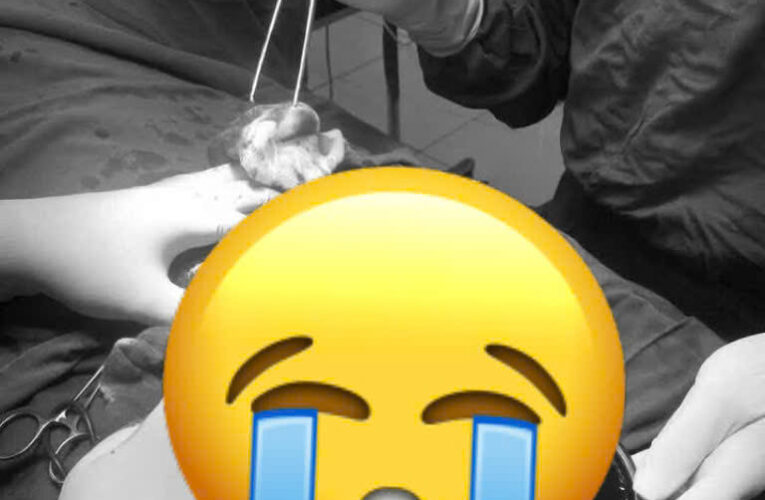 Thái Nguyên: Thanh niên đi đá bóng bị va chạm dẫn đến phải cắt bỏ T.i.n.h H.o.à.n